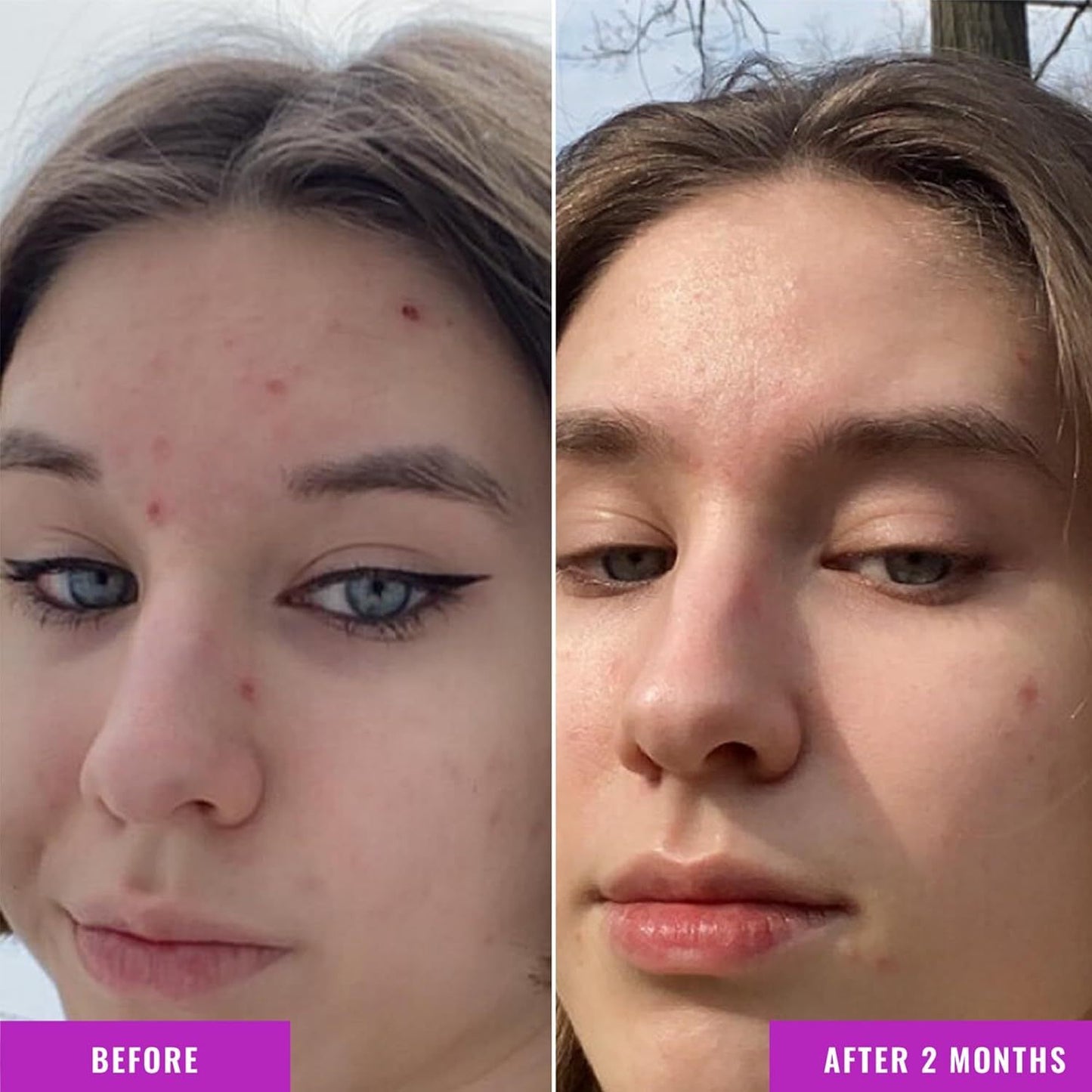 Anti-Wrinkle Nicotinamide Balance Facial Fluid - Mi tienda